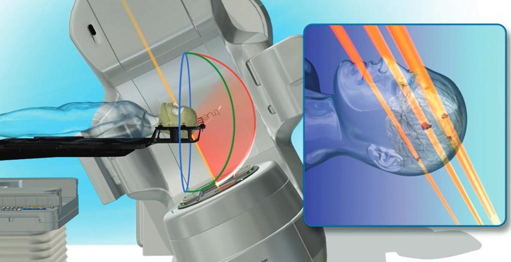 Image: The HyperArc radiotherapy system (Photo courtesy of Varian Medical Systems).