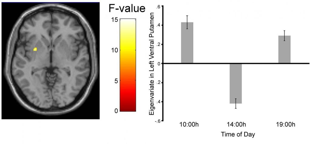 Image: The fMRI image shows that the activation of the reward-processing brain region peaks both in the morning and in the evening, but dips at 2 in the afternoon (Photo courtesy of Byrne et al., The Journal of Neuroscience 2017).