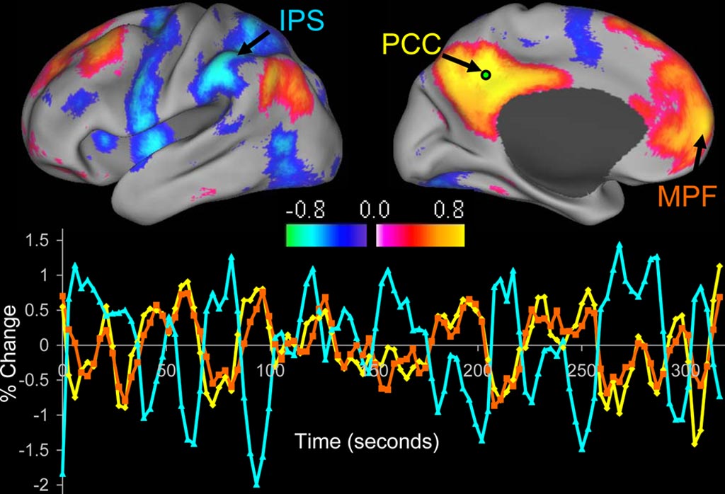 Image: The image shows an example of resting-state functional connectivity Magnetic Resonance Imaging (rsfcMRI) (Photo courtesy of Washington University).