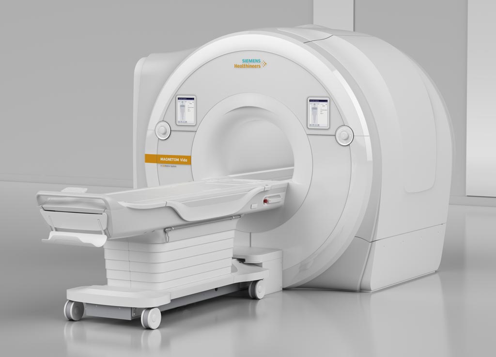 Image: The MAGNETOM Vida 3T MRI (Photo courtesy of Siemens Healthineers).