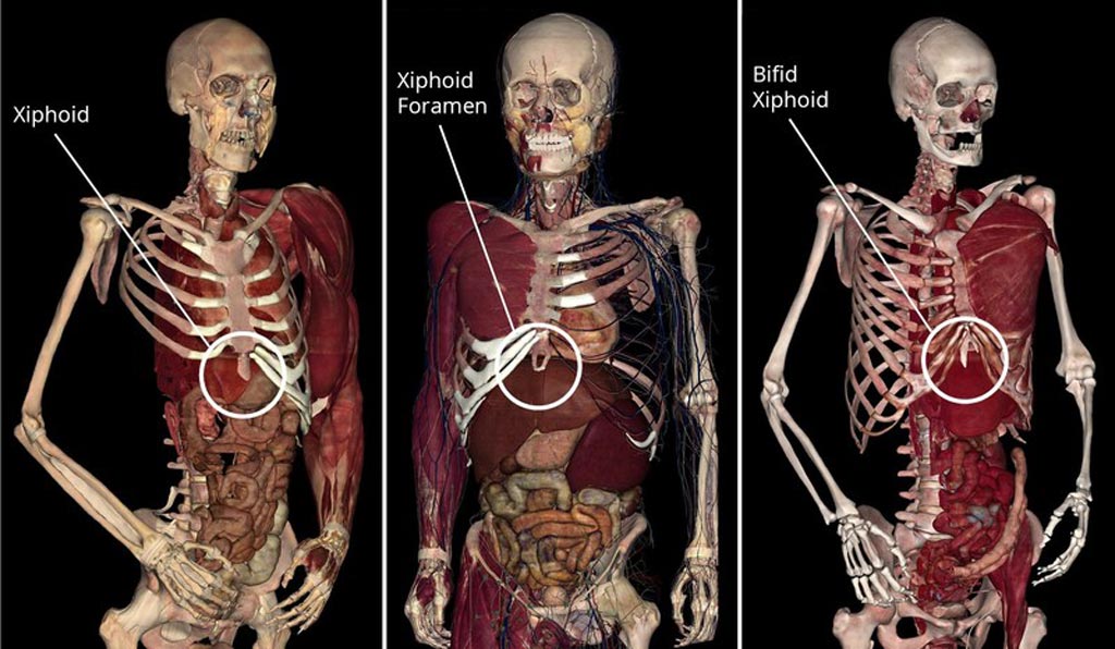 Image: Three-dimensional images from the high-tech anatomy visualization software (Photo courtesy of Anatomage).