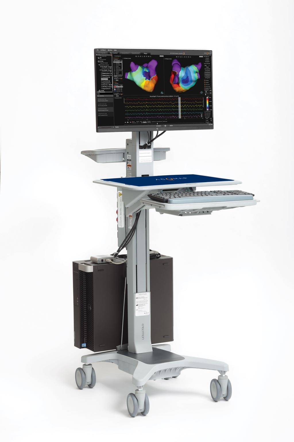 Image: The AcQMap high-resolution imaging and mapping system workstation (Photo courtesy of Acutus Medical).