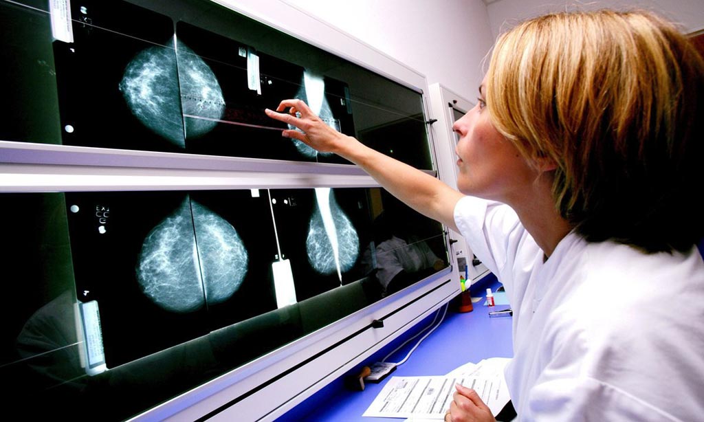 Image: New research asserts computer-aided detection of breast cancer is still being overused (Photo courtesy of Alamy).