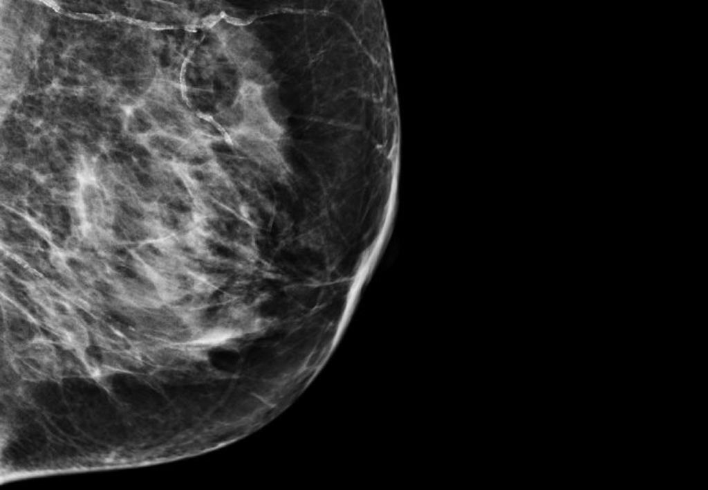 Image: A new research collaboration aims to improve breast cancer diagnosis using AI (Photo courtesy of Imperial College London).