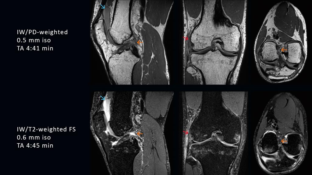 Image: High-resolution 3D isotropic images using the GOKnee3D app (Photo courtesy of Siemens Healthineers).