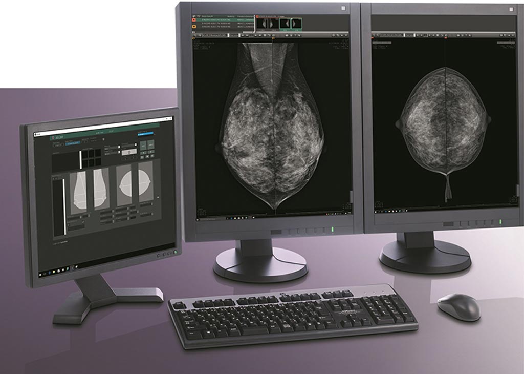 Image: The Aspire Bellus II smart mammography workstation (Photo courtesy of Fujifilm).