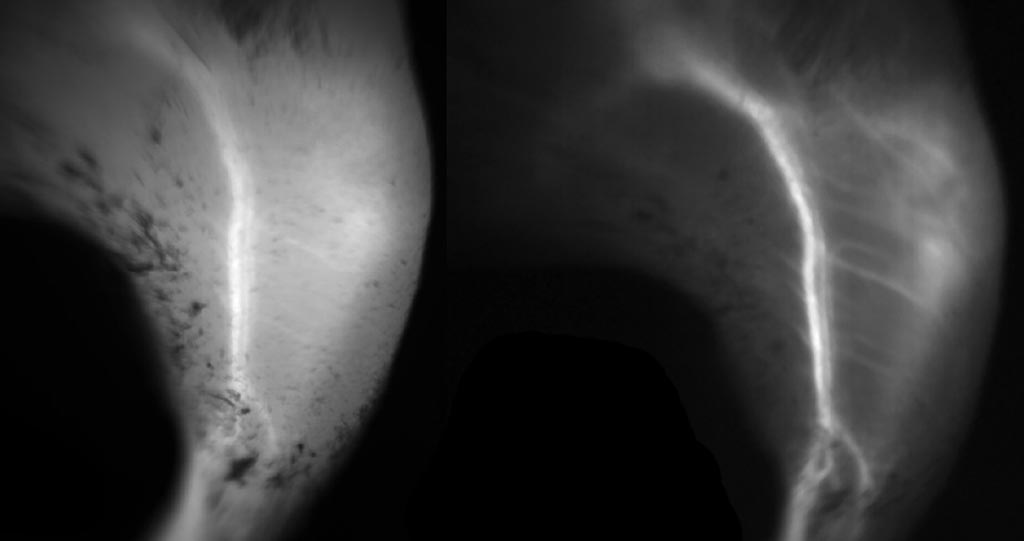 Image: Capillary imaging using NIR (L), as compared to SWIR (R), using ICG dye (Photo courtesy of MIT).
