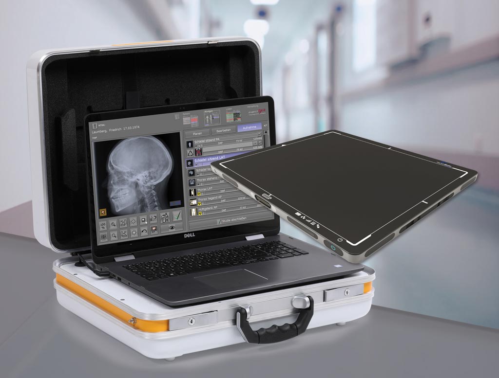Image: The Leonardo DR mini portable x-ray case (Photo courtesy of OR Technology).