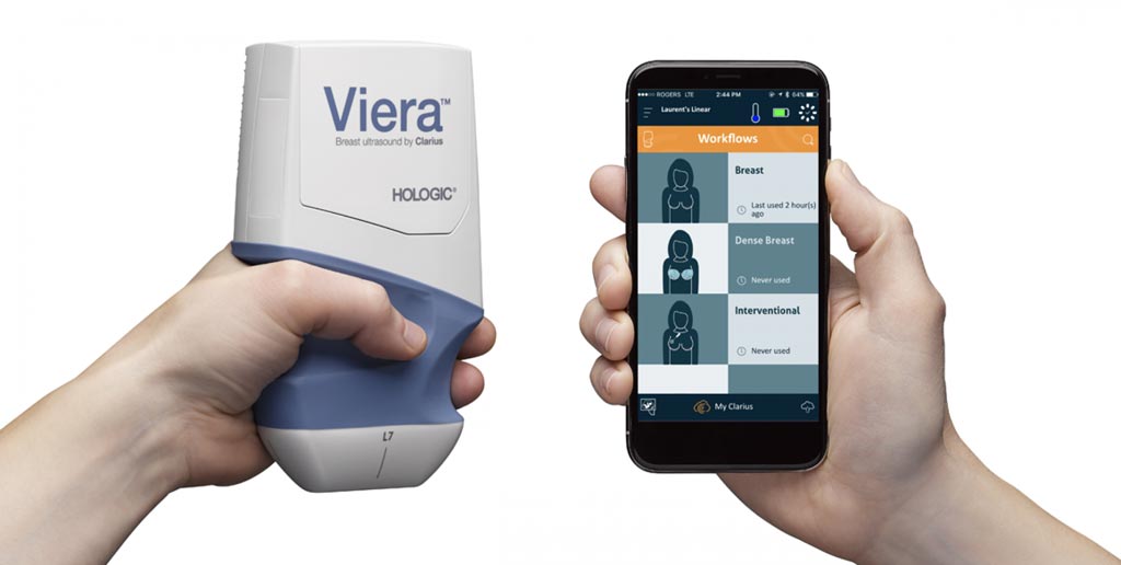 Image: The Viera portable breast ultrasound scanner (Photo courtesy of Hologic).