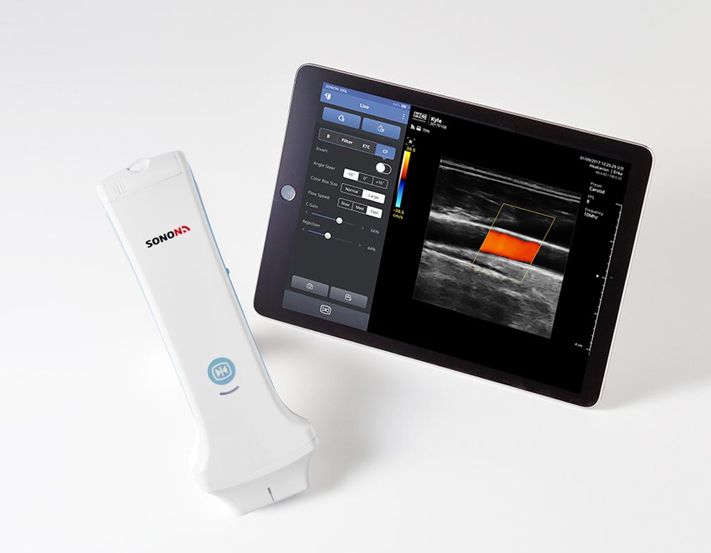 Image: A novel portable ultrasound device displays images on mobile devices (Photo courtesy of Healcerion).