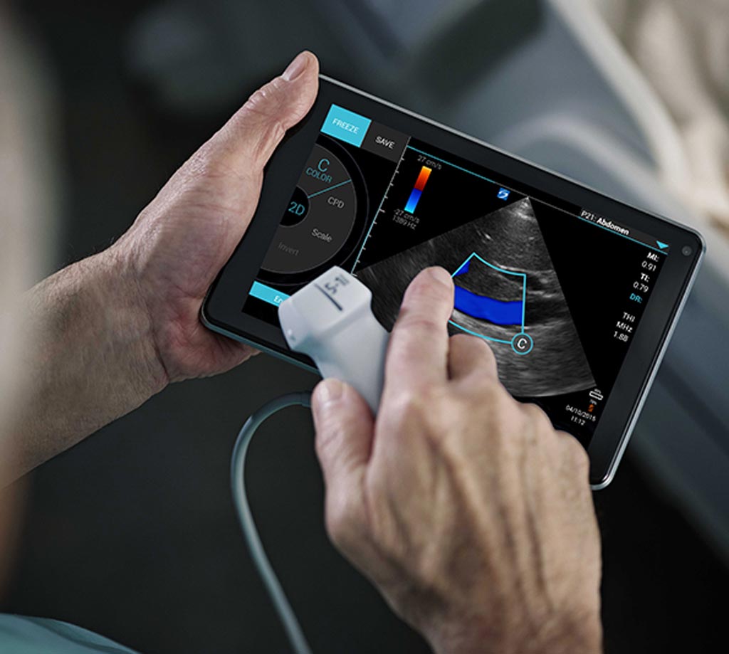Image: The iViz portable ultrasound device (Photo courtesy of Fujifilm SonoSite).
