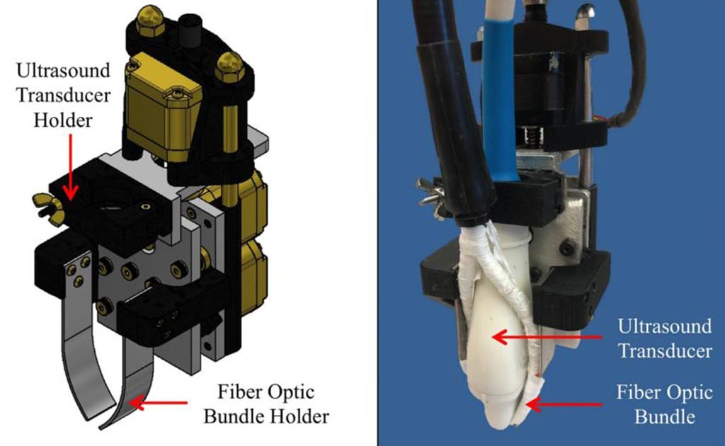 Image: A motorized photoacoustic probe holder helps improve light penetration depth and SNR (Photo courtesy of Purdue Research Foundation).