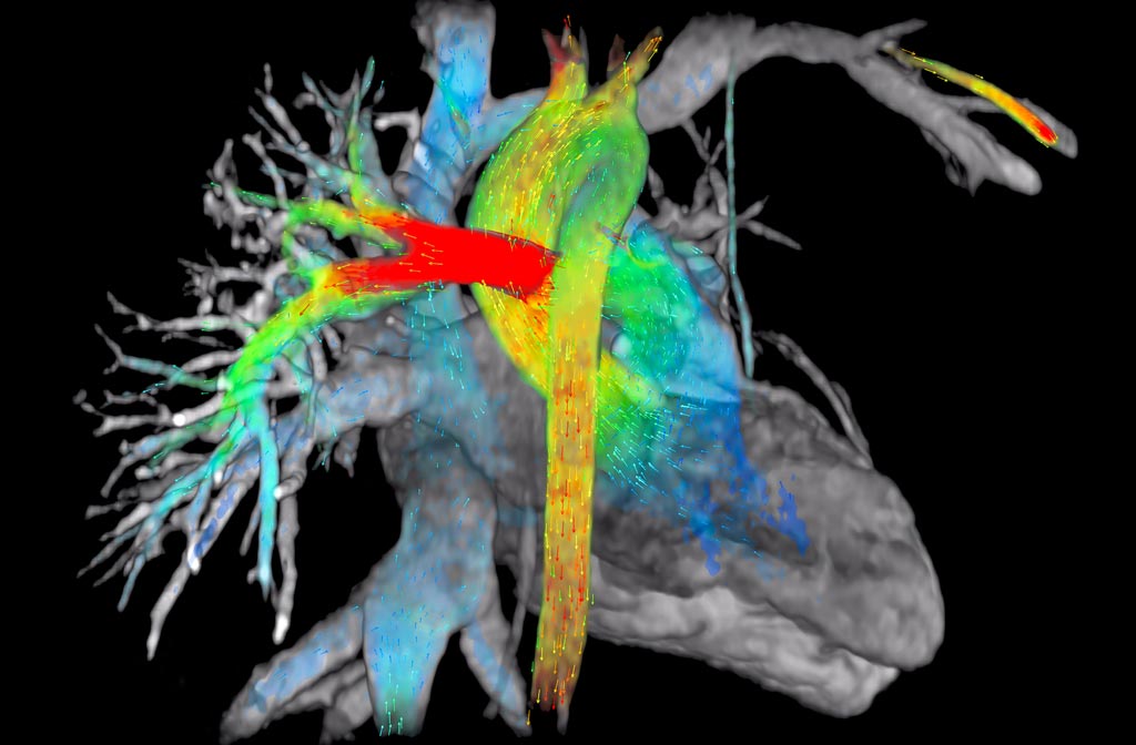 Image: A new study suggests that cardiac MRI can help detect lupus before symptoms appear (Photo courtesy of GE Healthcare).