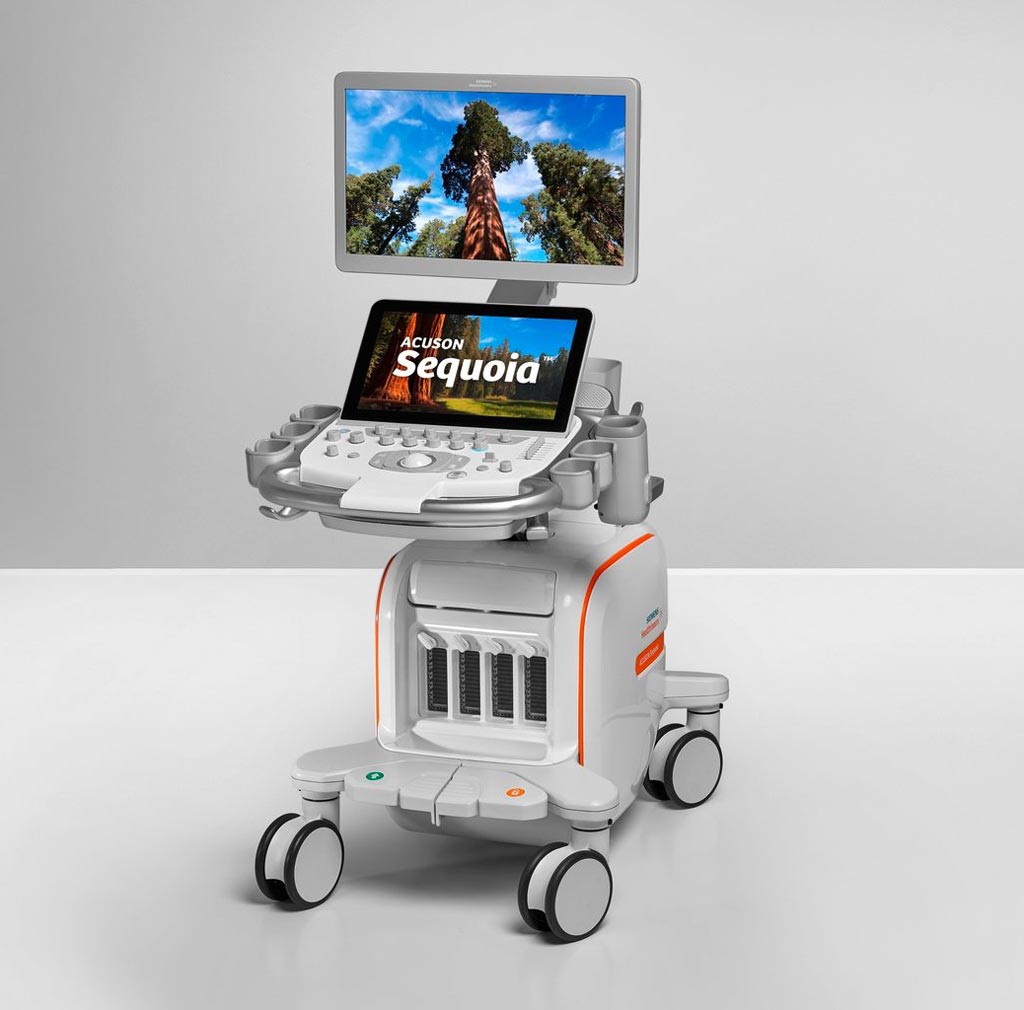 Image: The Acuson Sequoia is designed to adapt to variations of each patient (Photo courtesy of Siemens Healthineers).
