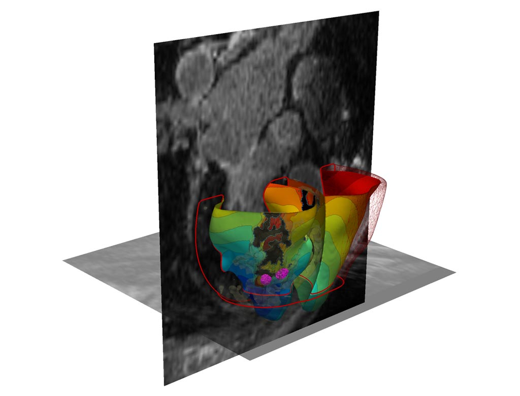 Image: A 3D simulated virtual heart (Photo courtesy of JHU).
