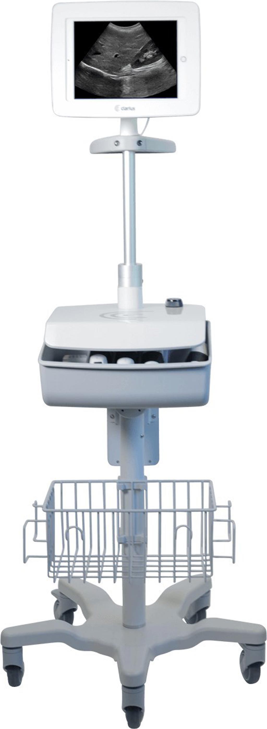 Image: A dedicated ultrasound cart holds multiple wireless scanners (Photo courtesy of Clarius).