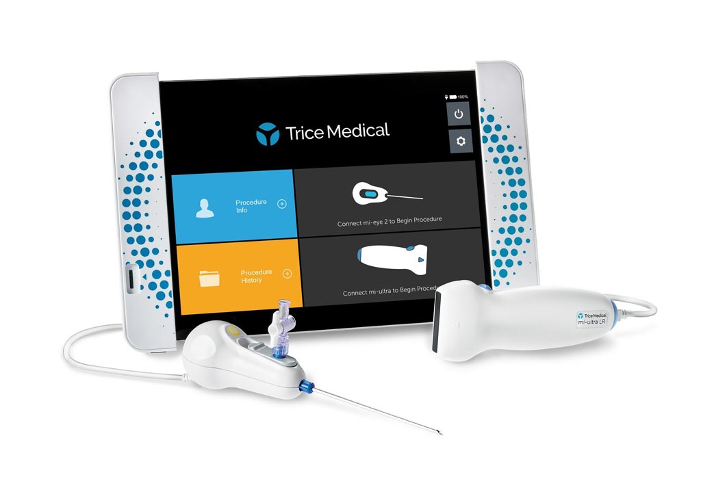 Image: The Trice dynamic imaging platform, featuring the mi-eye, mi-ultra, and mi-tablet (Photo courtesy of Trice Medical).