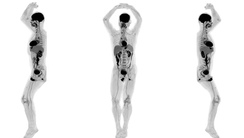 Total-Body Scanner Unveils First Human Images - General Imaging -  mobile.