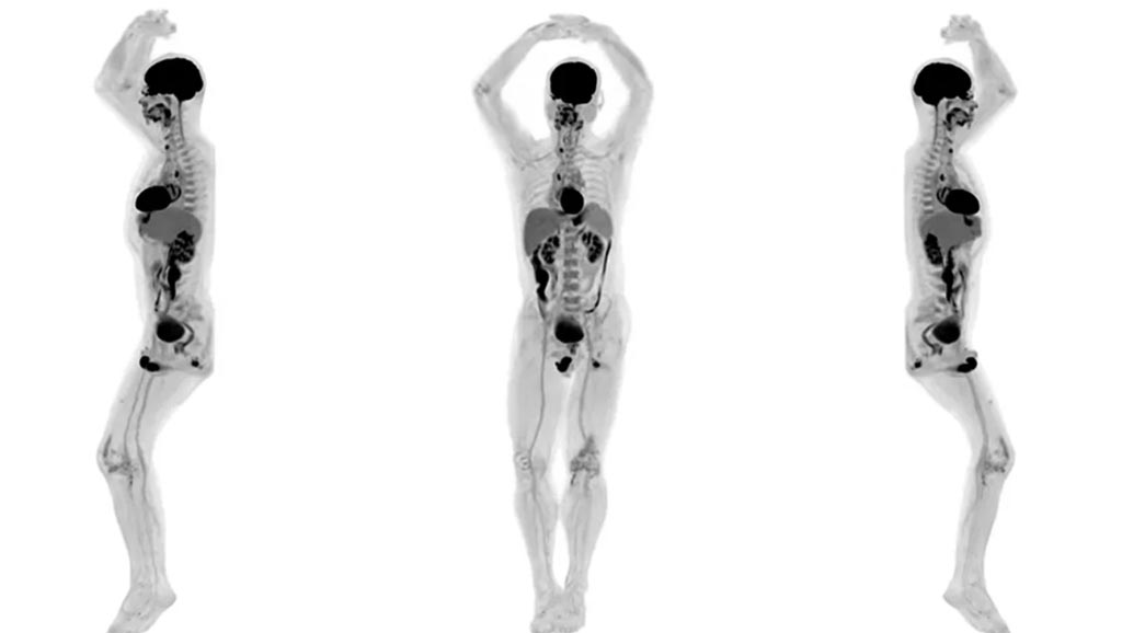 Human images from world's first total-body scanner unveiled