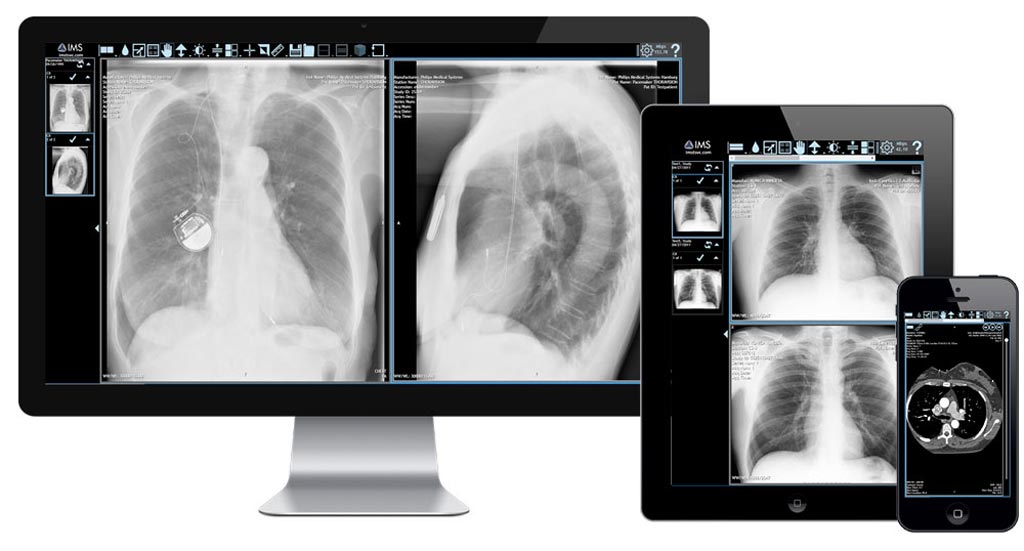 Image: A merged cloud platform allows rapid sharing of images (Photo courtesy of IMS).