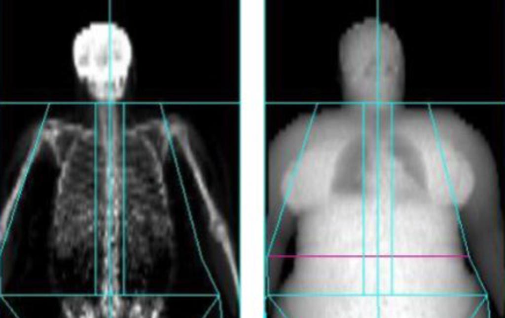 Image: A new study claims that obese patients are exposed to more radiation (Photo courtesy of University of Exeter).