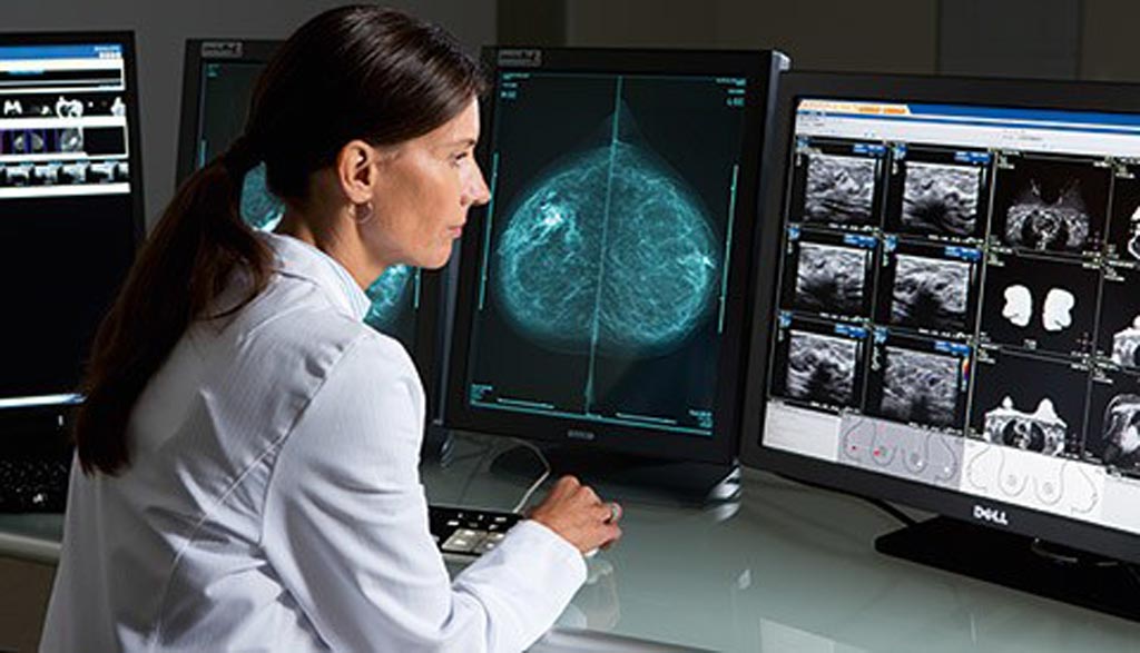 Image: The global medical imaging workstations market is projected to grow from USD 897 million to USD 1.38 billion by 2023 (Photo courtesy of Philips Healthcare).
