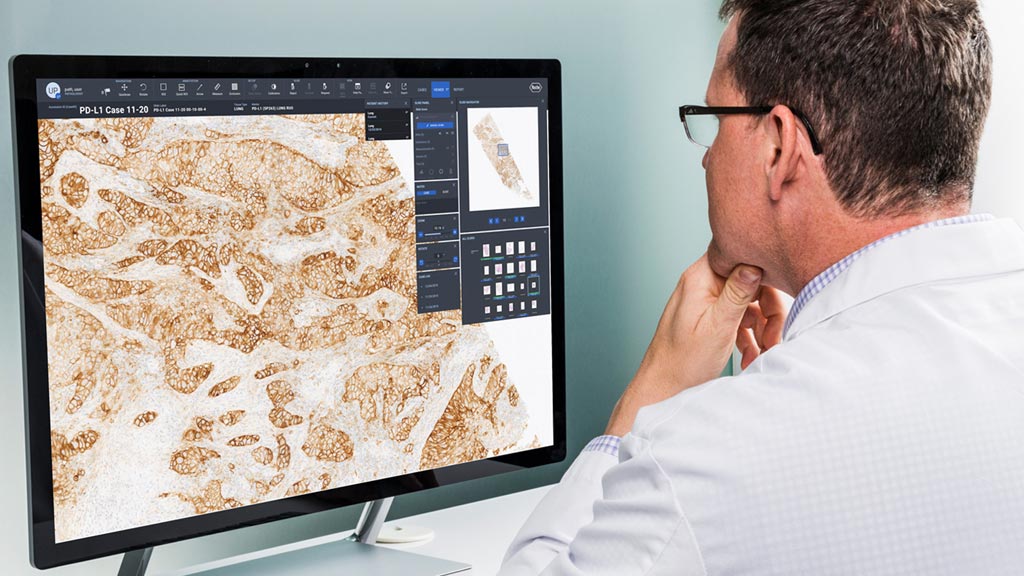 Image: uPath enterprise software provides improved digital pathology tools (Photo courtesy of Roche).