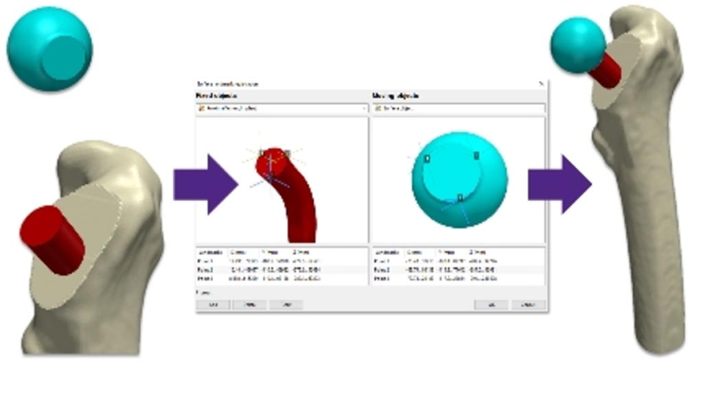 Image: Detail from the Simpleware ScanIP medical software tool (Photo courtesy of Synopsys).