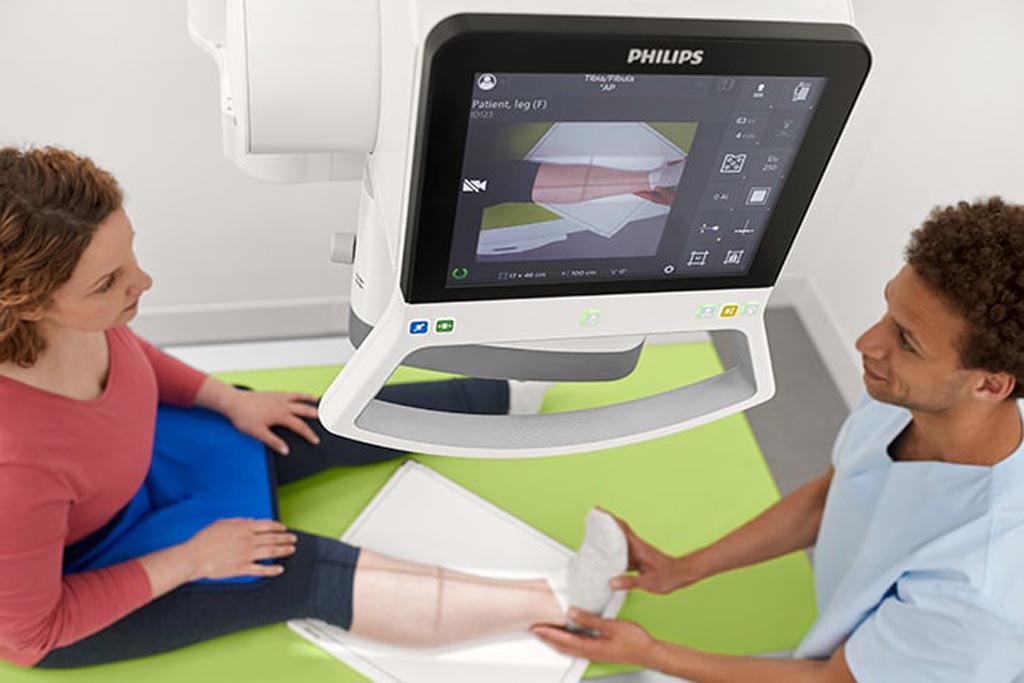 Image: A fibula exam being prepared on the DigitalDiagnost C90 DR System (Photo courtesy of Philips Healthcare).