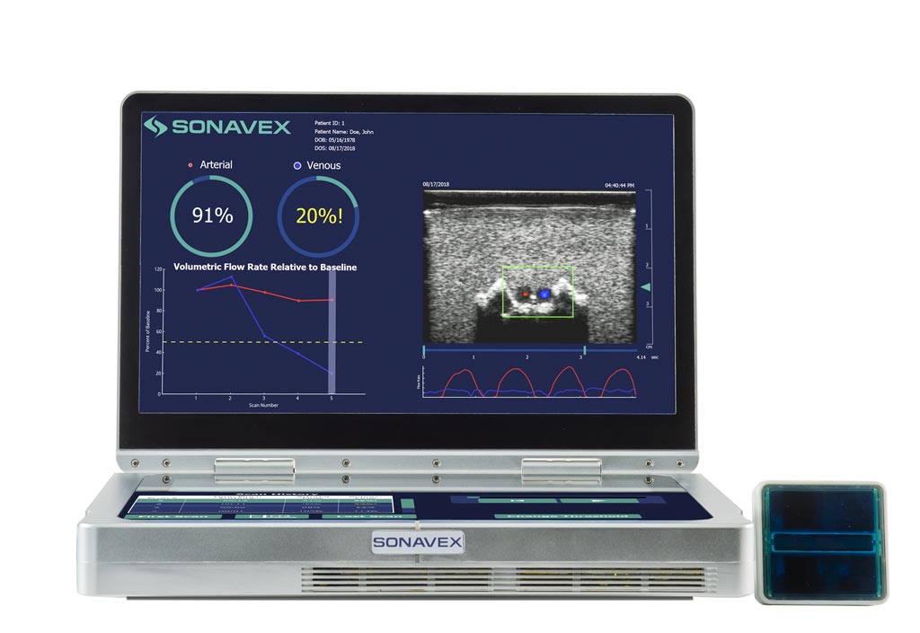 Image: The EchoSure portable ultrasound system detects blood clots (Photo courtesy of Sonavex).