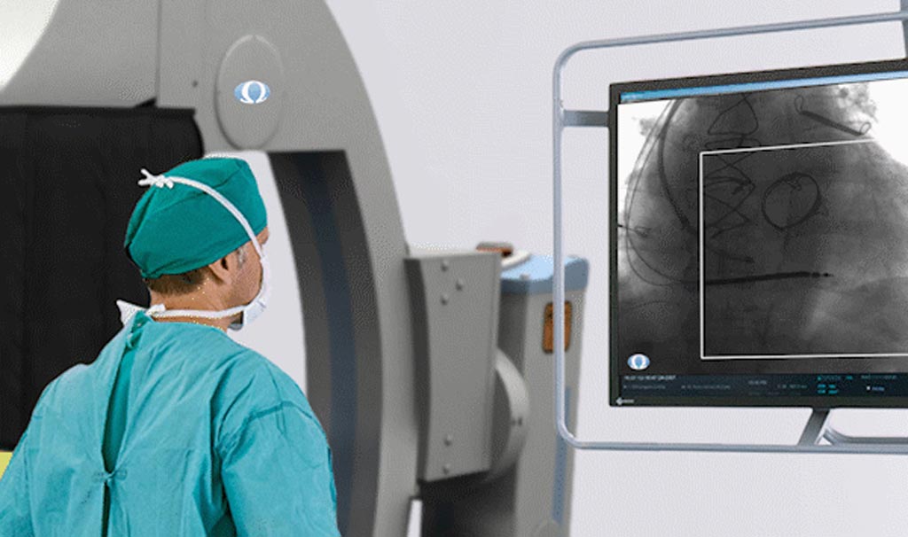 Image: A radiation exposure reduction system that uses AI (Photo courtesy of Omega Medical Imaging).