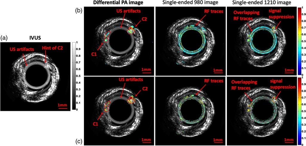 Image: Photoacoustic radar uses two different light sources to identify cholesterol (Photo courtesy of JBO).