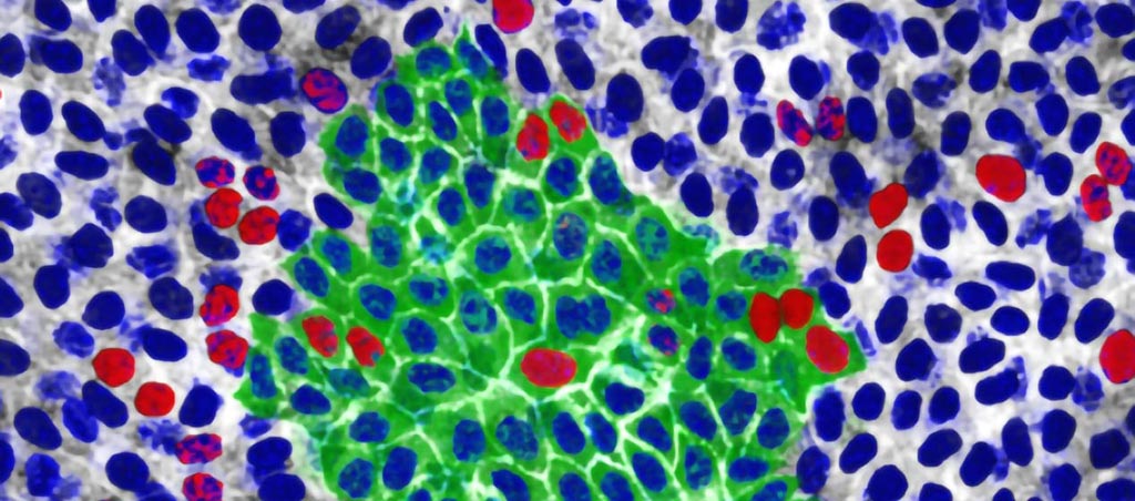 Image: p53 mutant cells (red and green) expansion in mouse esophageal tissue (Photo courtesy of Wellcome Sanger Institute).