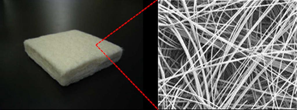 Image: A biodegradable polyglycolic acid spacer preserves healthy tissues during RT (Photo courtesy of Kobe University).