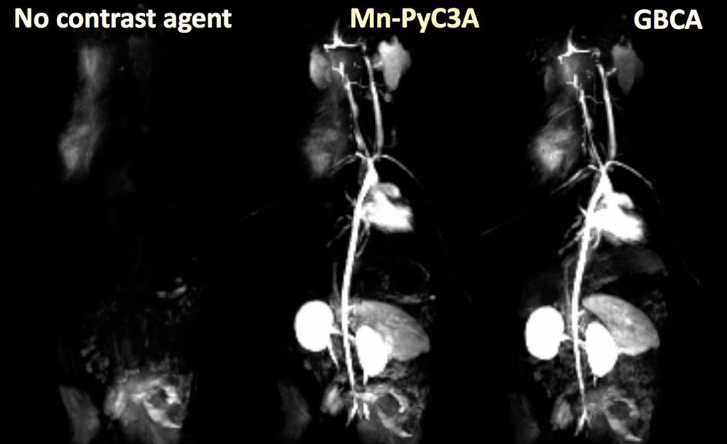 Image: A Manganese-based contrast agent could make MRI safer (Photo courtesy of Eric Gale/ MGH/Reveal Pharmaceuticals).
