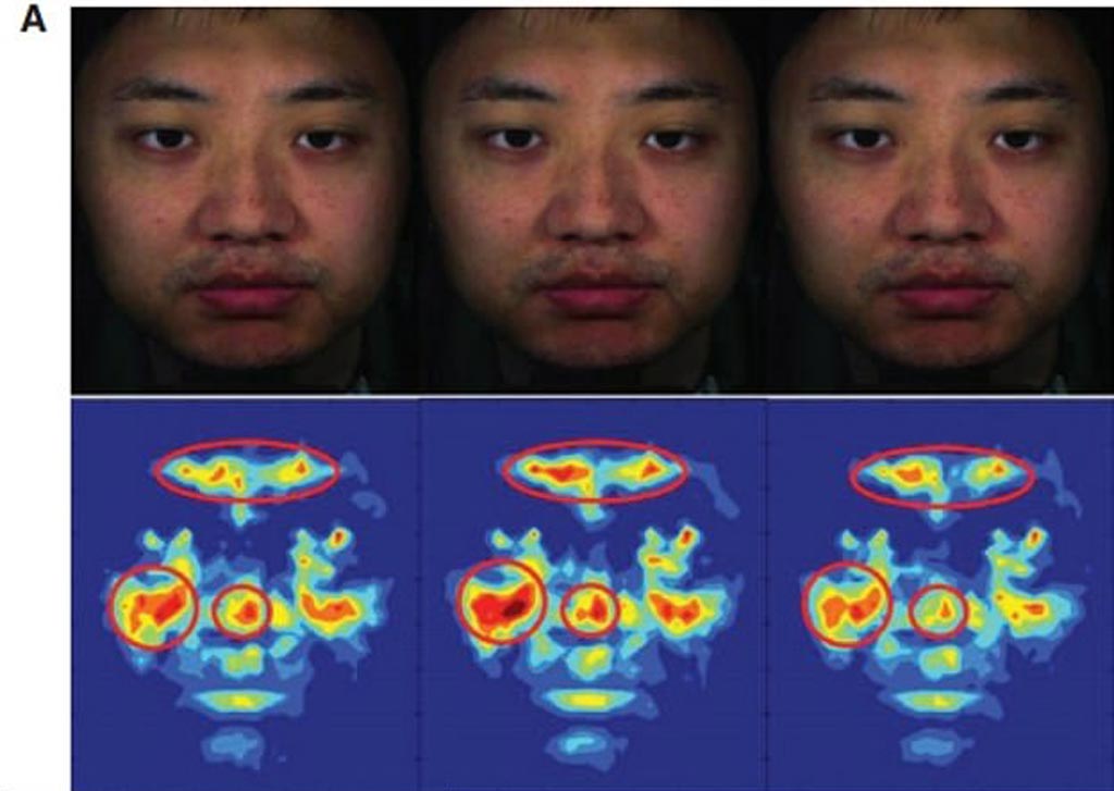 Image: A new study claims that specific areas of the human face can be used to optically measure BP (Photo courtesy of Kang Lee/ UT).