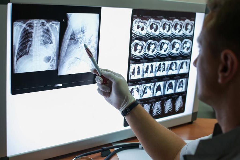 Image: At the same time that the role of non-physicians is on the rise, they actually perform less than 2% of imaging interpretations, according to a new study (Photo courtesy of MPMN).