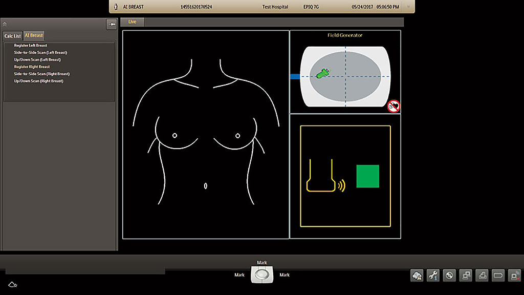 Image: AI Breast (Photo courtesy of Philips Healthcare)
