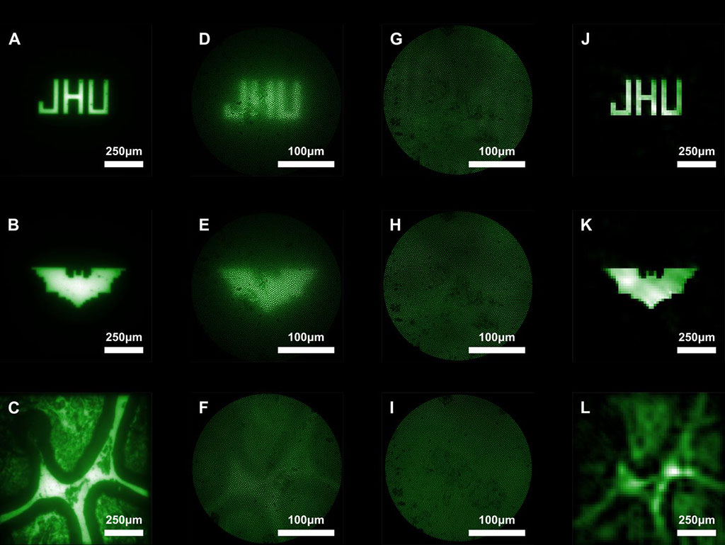 Image: Images captured with conventional miniature endoscopes and the new lensless microendoscope (Photo courtesy of Mark Foster/ JHU)