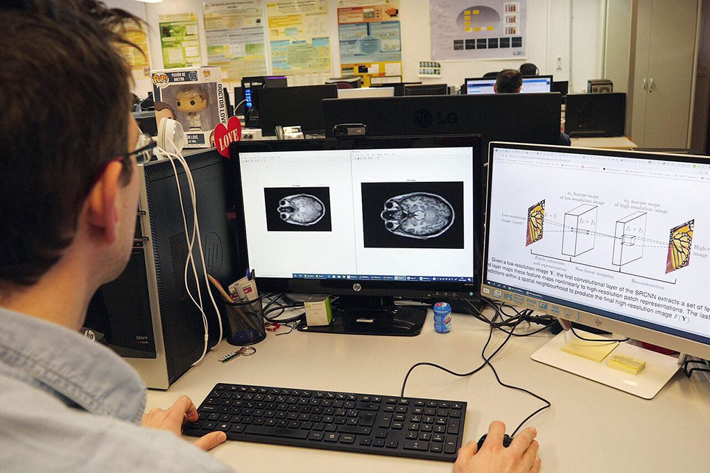 Image: Dr. Karl Thurnhofer compared native and enhanced MRIs (Photo courtesy of UMA)
