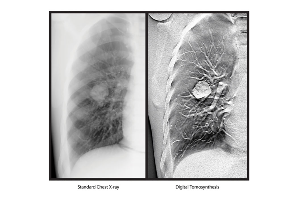 Image: DT turns two dimensional images into 3D datasets (Photo courtesy of Carestream)