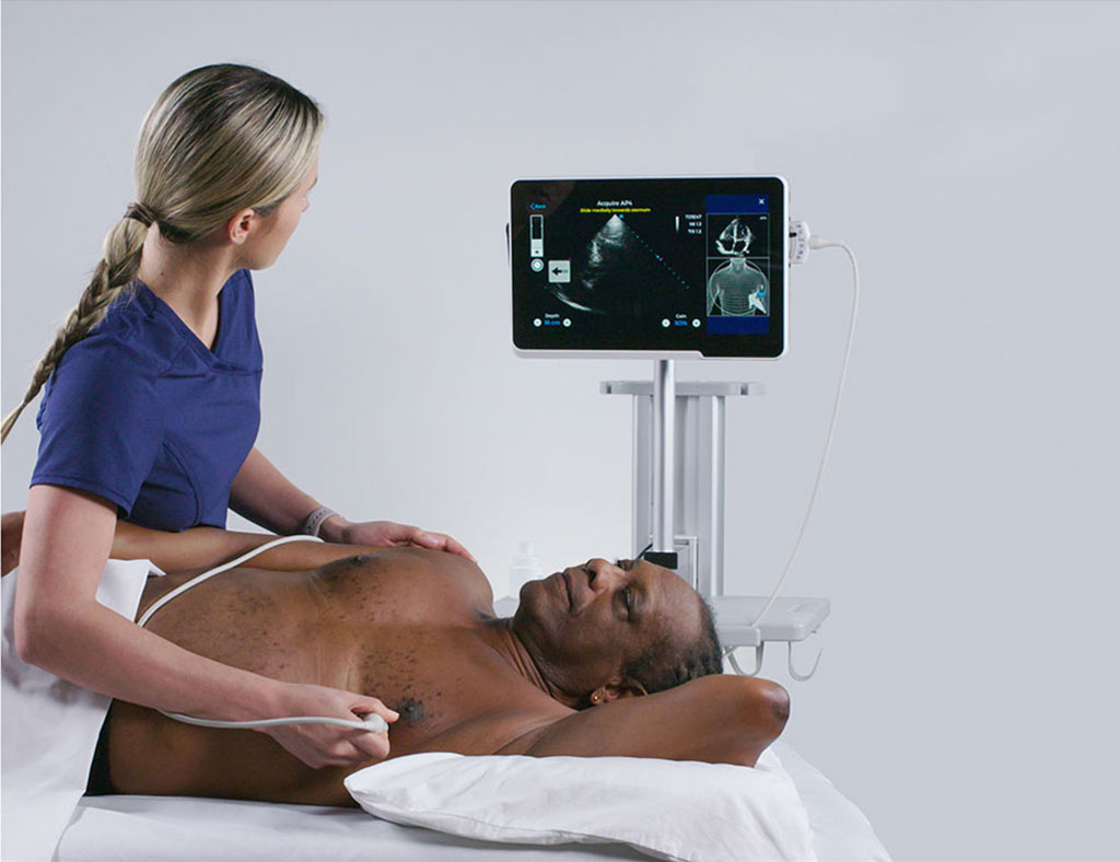Image: Using Caption, a nurse can perform a cardiac ultrasound without prior experience(Photo courtesy of Caption Health)