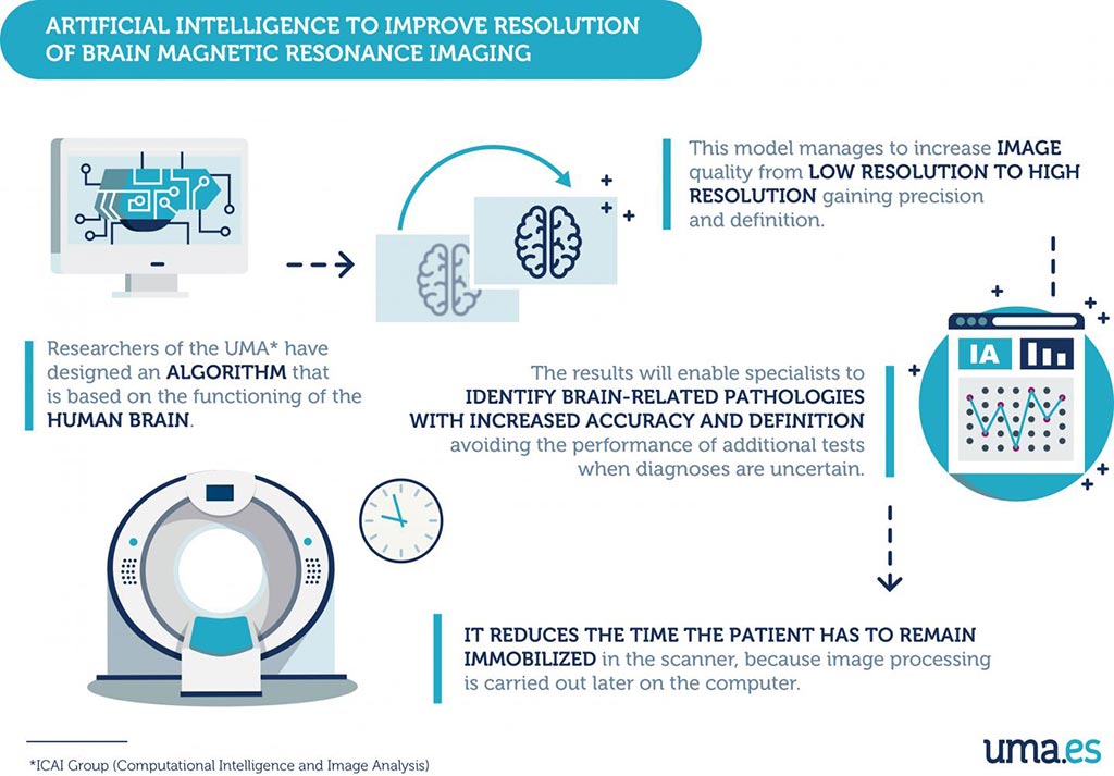 Image: Artificial intelligence to improve resolution of brain magnetic resonance imaging (Photo courtesy of University of Malaga)