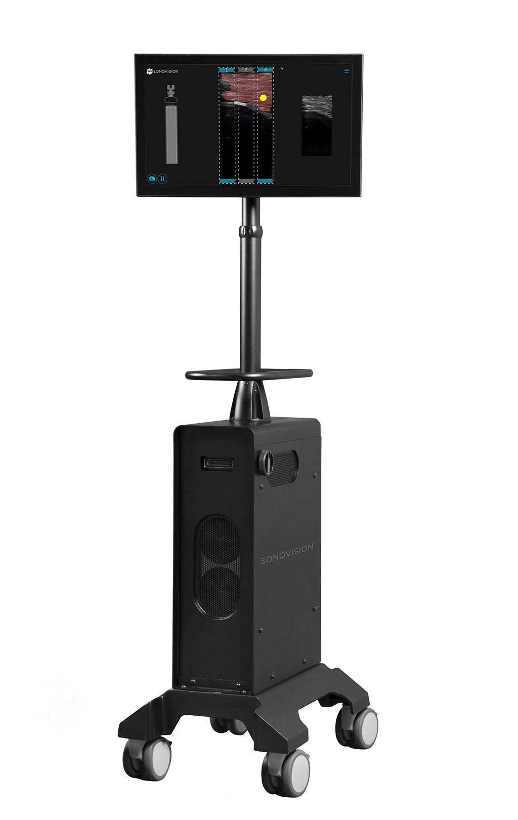 Image: The SonoVision ultrasound imaging system (Photo courtesy of TDi).