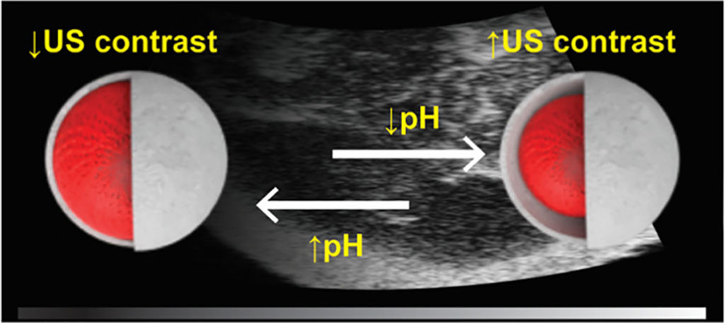 Image: Coated Silica cores change in response to Ph, which can be detected by ultrasound (Photo courtesy of Monash University)