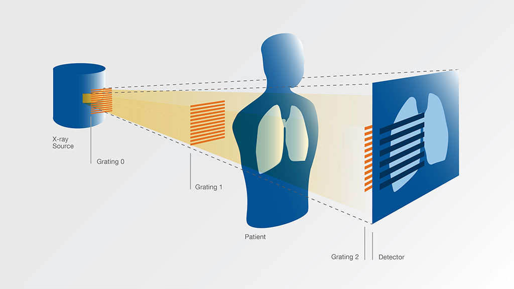 Image: Schematic of a device for x-ray dark field imaging (Photo courtesy of TUM)