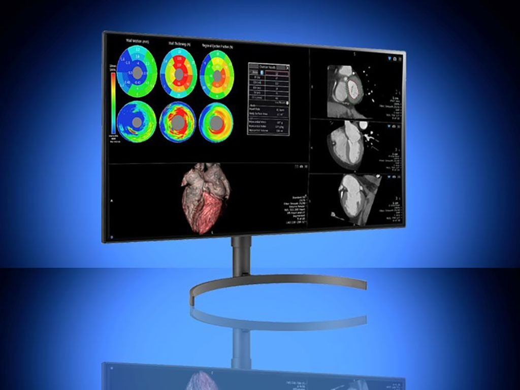 Image: The LGE Model 32HL512D-B with DBI Calibration Software Suite (Photo courtesy of DBI)