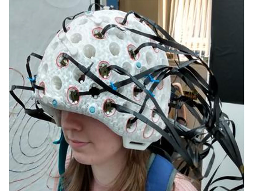 Image: The 49 channel 3D printed whole head brain scanner (Photo courtesy of the University of Nottingham)