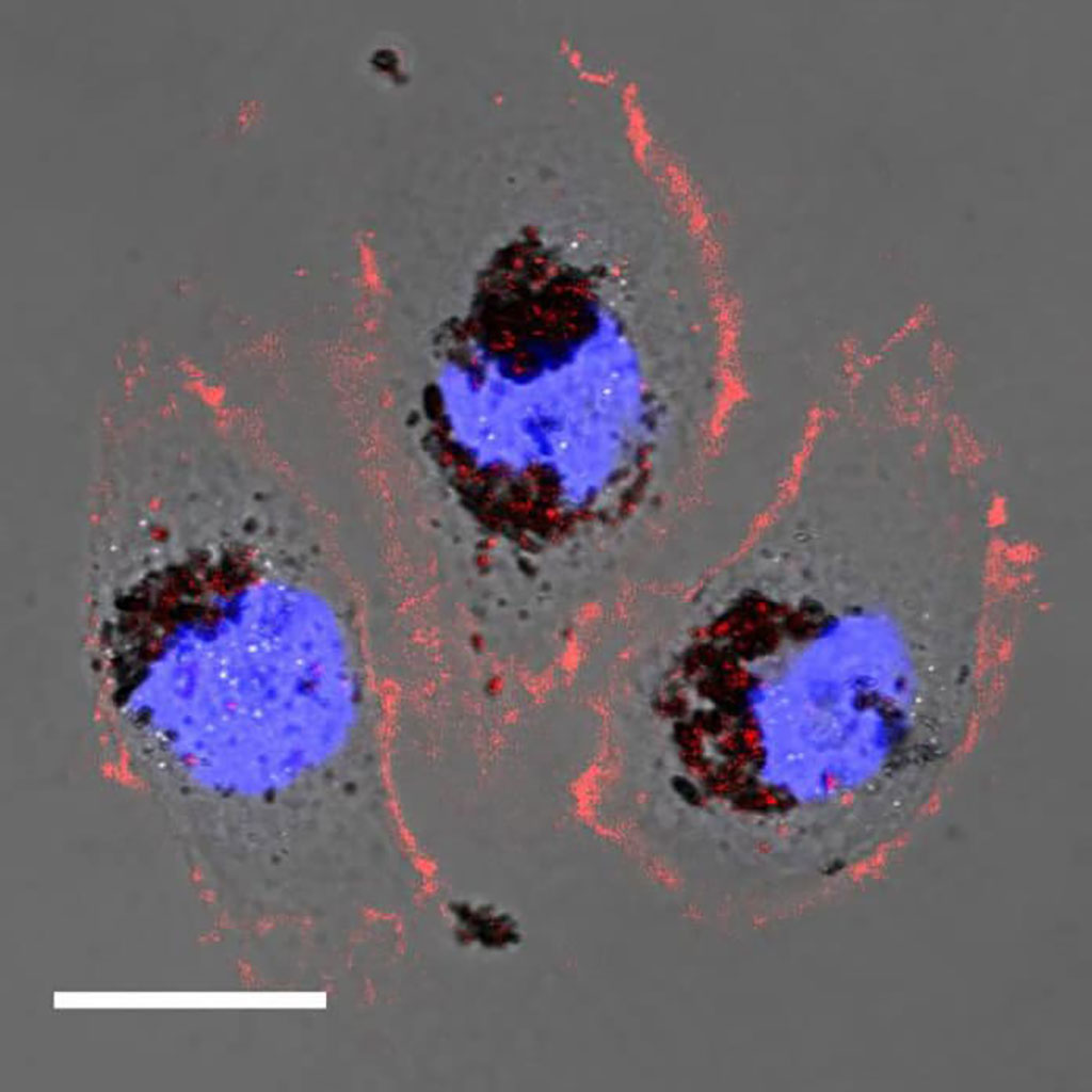 Image: Human cells treated with Selenomelanin nanoparticles (Photo courtesy of NU)