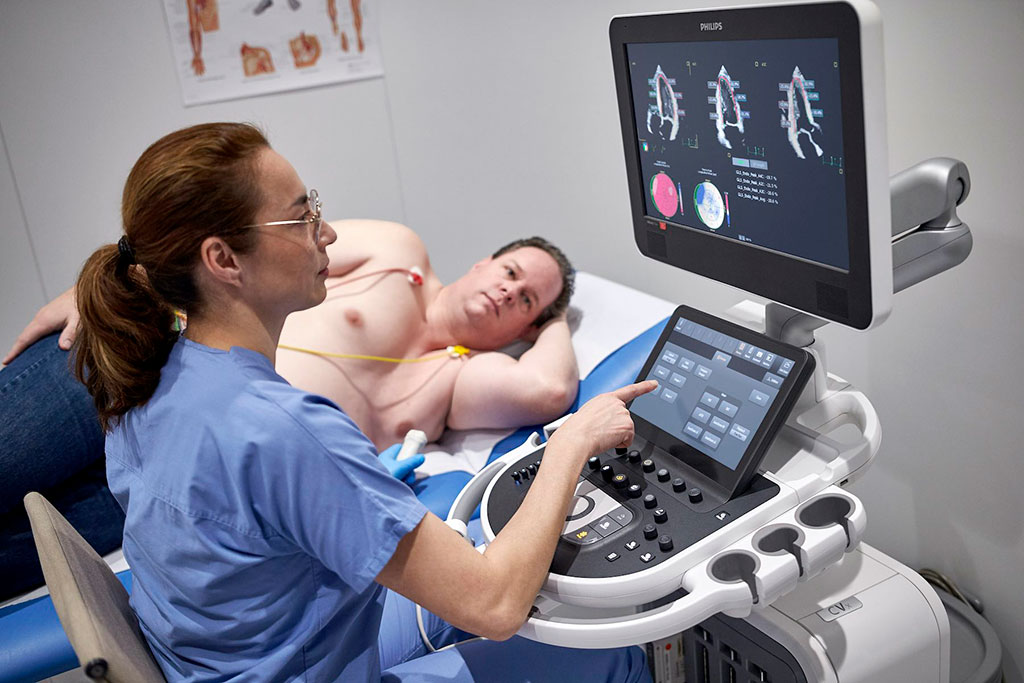 Image: The Philips Affiniti CVx ultrasound device (Photo courtesy of Philips)